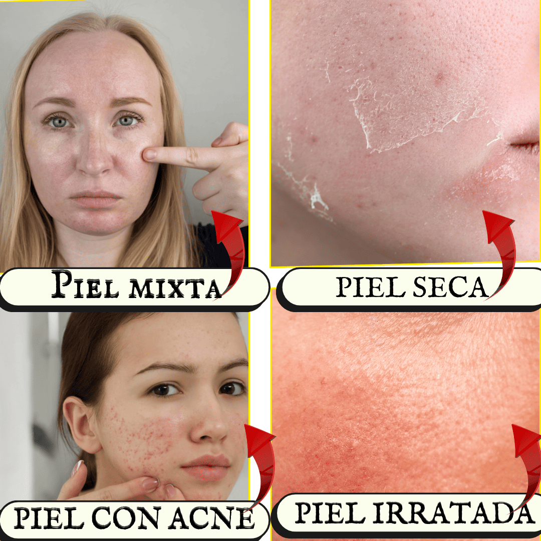 ANUA° Niacinamide